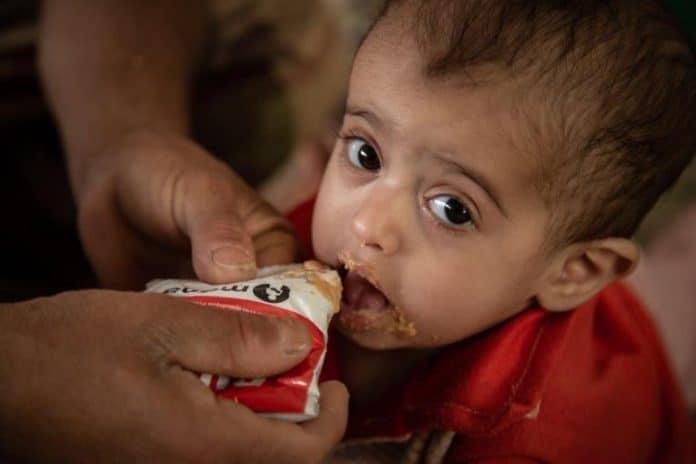 Child in Yemen