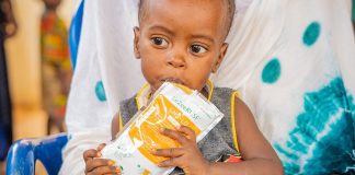 Guterres: Il diritto umano al cibo necessita di "investimenti massicci". © UNICEF/Tiécoura N’Daou