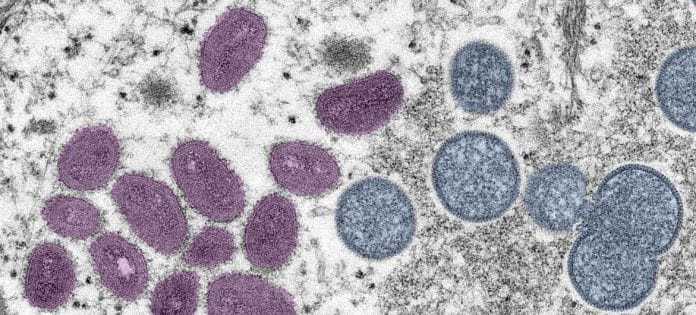 Fargelagt transmisjonselektronmikroskopisk bilde av mpox-viruspartikler (rødt) i en infisert celle (blått) som har blitt dyrket i laboratoriet. Foto: NIAID